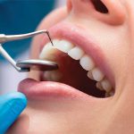 Dental Implant, Dental Cosmetic Miami