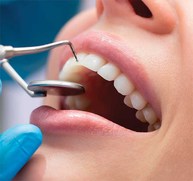 Dental Implant, Dental Cosmetic Miami