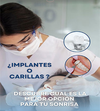 Carillas y Coronas - Dental Cosmetic Miami