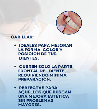 Carillas y Coronas - Dental Cosmetic Miami