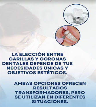 Carillas y Coronas - Dental Cosmetic Miami