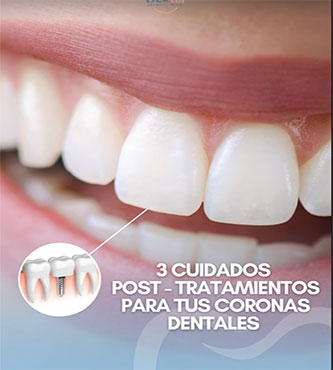 Coronas Dentales - Dental Cosmetic Miami