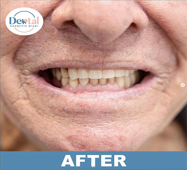 Transformation-Dental Cosmetic Miami