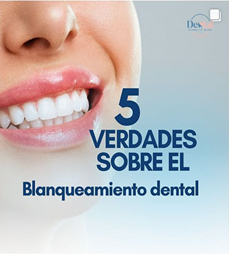 Blanqueamiento Dental - Dental Cosmetic Miami