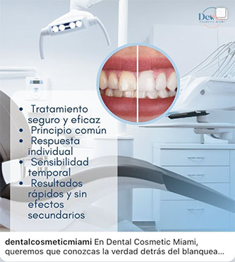 Blanqueamiento Dental - Dental Cosmetic Miami
