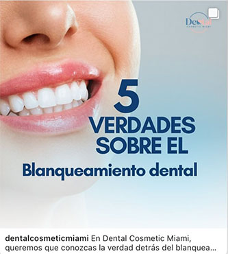 Blanqueamiento Dental - Dental Cosmetic Miami