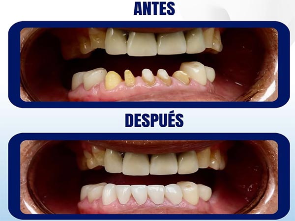 Dental Cosmetic Miami