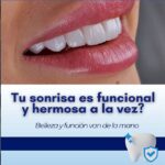 Smile-Desing